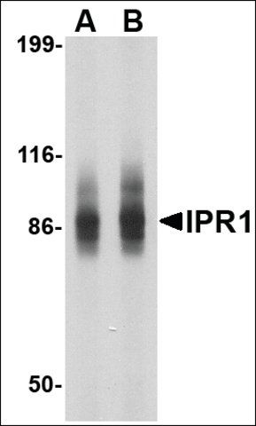 Anti-IPR1 (ab2) antibody produced in rabbit