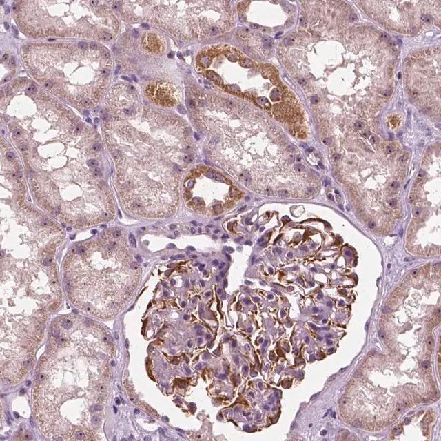 Anti-ODF3L2 antibody produced in rabbit