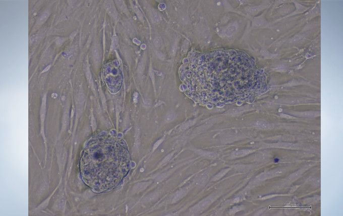 奥林巴斯倒置显微镜CKX53示例图4